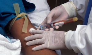 Медики: В Запорожье пока не было случаев заражения СПИДом в больницах