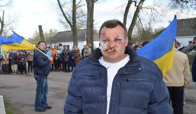 Жители Гуляйпольского района просят Ляшко наказать тех, кто зверски пытал главу сельсовета