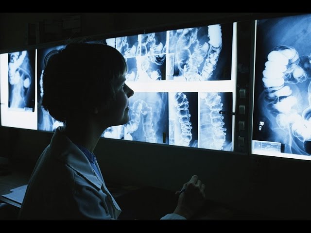 В Запорожской больнице появится новый рентген стоимостью более 2 миллионов гривен