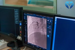Коронарография - самый достоверный метод диагностики болезней сердца