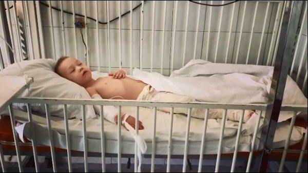 В запорожскую больницу попал 5-летний мальчик, который вылил на себя кастрюлю с супом