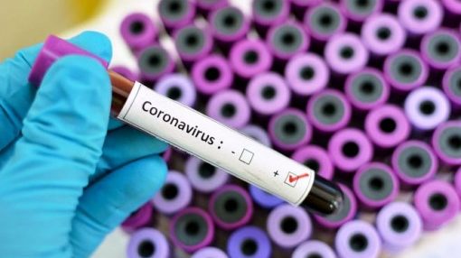 Всего – 5 заболевших: стали известны подробности о первых случаях коронавируса в Запорожской области
