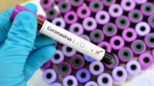 Оновлено: у Запорізькій області на коронавірус перевіряють 17 людей