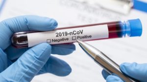 У Запорізькій області збільшилася кількість хворих на коронавірус: вже 22 випадки COVID-19