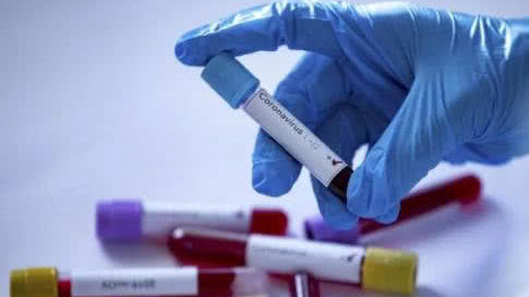 В Запорожской области подтвердили два случая заболевания коронавирусом