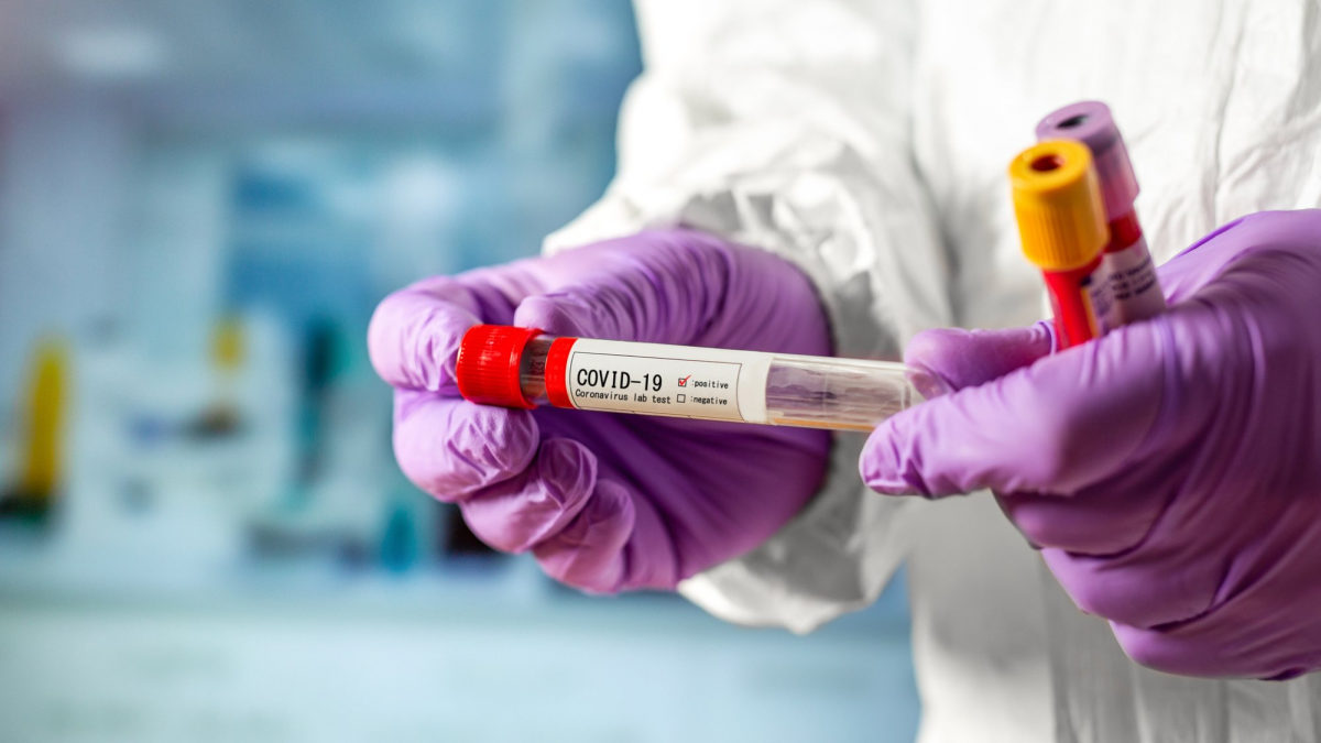 У Запоріжжі і області виявили 40 нових випадків коронавірусу: найбільше – у Мелітополі і Токмаку