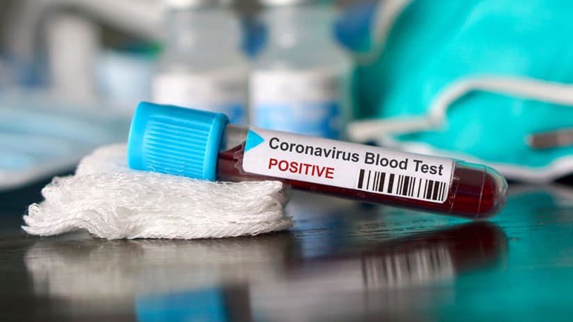 У Запоріжжі зафіксовано нові випадки коронавірусу