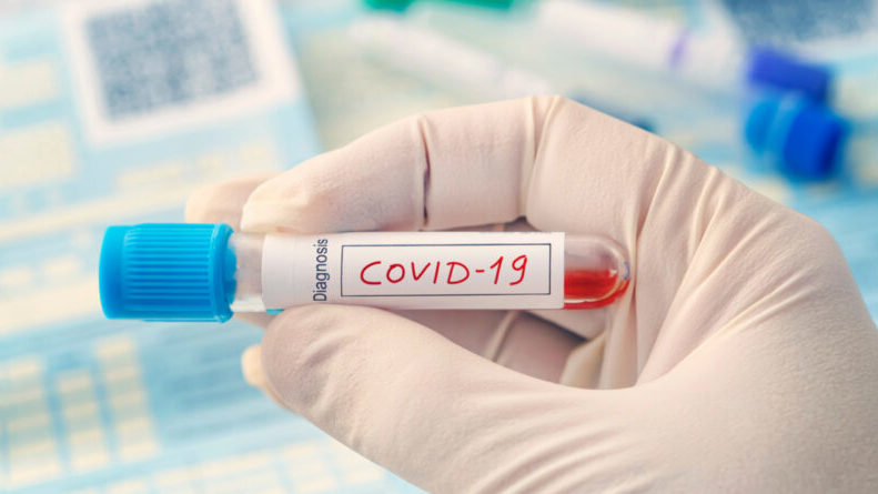 Количество больных COVID-19 в Запорожской области за последние сутки увеличилось на 9 человек