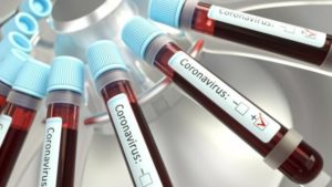 Лікарі підтвердили нові випадки захворювання на COVID-19 в Запорізькій області