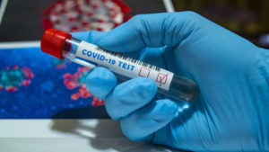 Запорожские эпидемиологи сообщают о еще полсотне новых случаев коронавируса