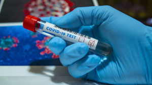 У Запоріжжі за вчорашній день зробили рекордну кількість тестів на коронавірус
