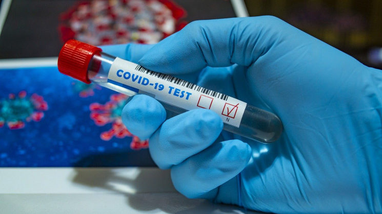 В Запорізькій області коронавірусом за добу захворіло трохи більше 200 людей