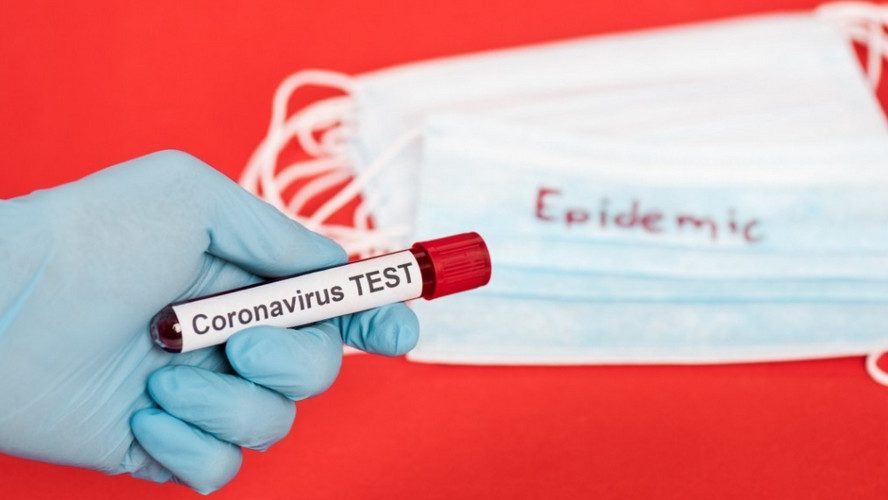 В Запорожской области обнаружили новые случаи коронавирусной инфекции