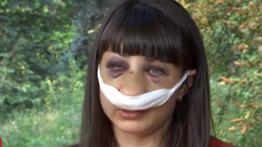 Сломанный нос и сотрясение мозга: подробности избиения девушки в запорожском магазине, - ВИДЕО