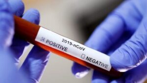 Более 1400 запорожцев заболели коронавирусом за последние 24 часа