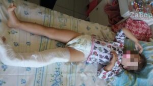 У дитсадку Запорізької області серйозно постраждала маленька дитина
