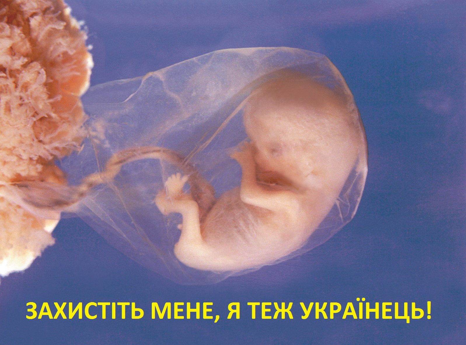 Запорожцев зовут на марш, чтобы защитить нерожденных детей