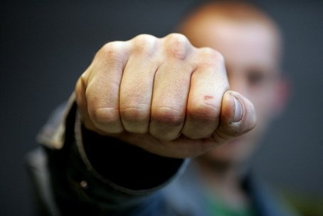 Запорожцу разбили голову его же два товарища