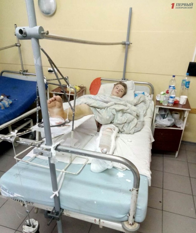 Нужна помощь: молодому запорожцу, который упал с третьего этажа, сделают несколько операций - ФОТО
