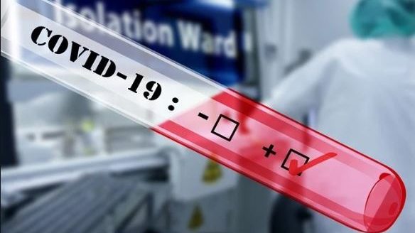У Запоріжжі за добу рекордно збільшилася кількість хворих на COVID-19