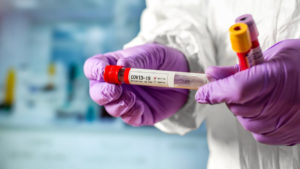 У Запорізькій області другу добу поспіль рекордно зростає кількість хворих COVID-19