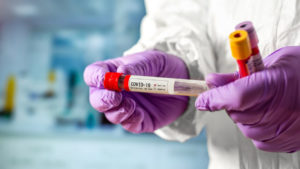В Запорожской области зарегистрировали 571 новый случай заболевания COVID-19