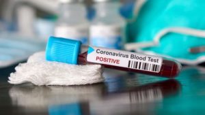 У Запоріжжі продовжується зростання кількості хворих на COVID-19