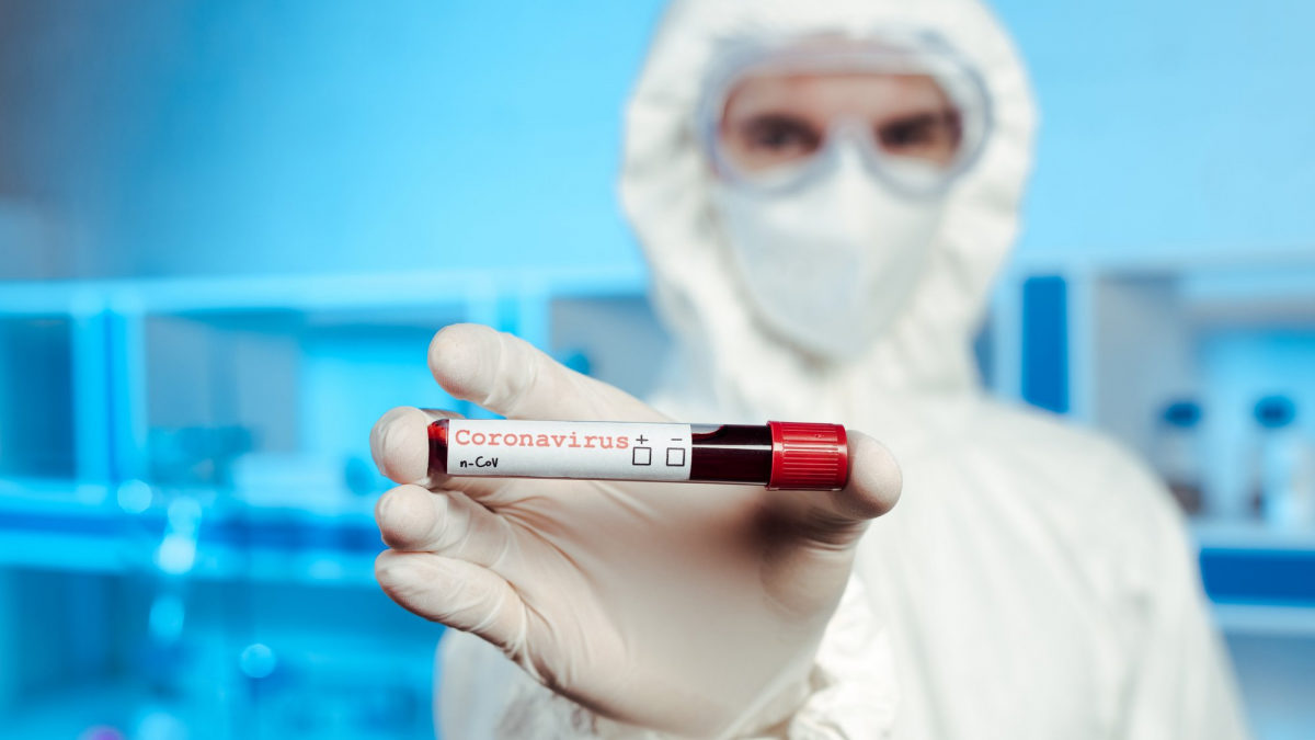В Запорожской области растет количество новых случаев COVID-19 – еще 1059 заболевших