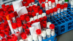 Запорізька область входить до ТОП-3 за кількістю хворих COVID-19 правоохоронців