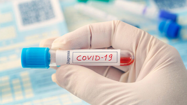 В Запорожье и области продолжает расти количество больных COVID-19: еще 9 новых случаев