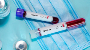 В Запорожской области значительно возросло количество больных COVID-19: более 150 случаев за сутки
