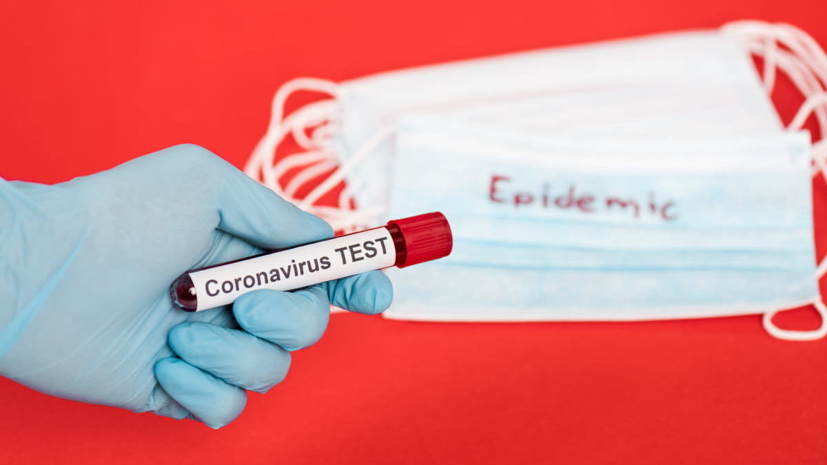 У Запорізькій області за минулий день зафіксували 211 нових випадків COVID-19