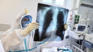 В Запорожской области из-за COVID-19 скончались еще 16 жителей региона