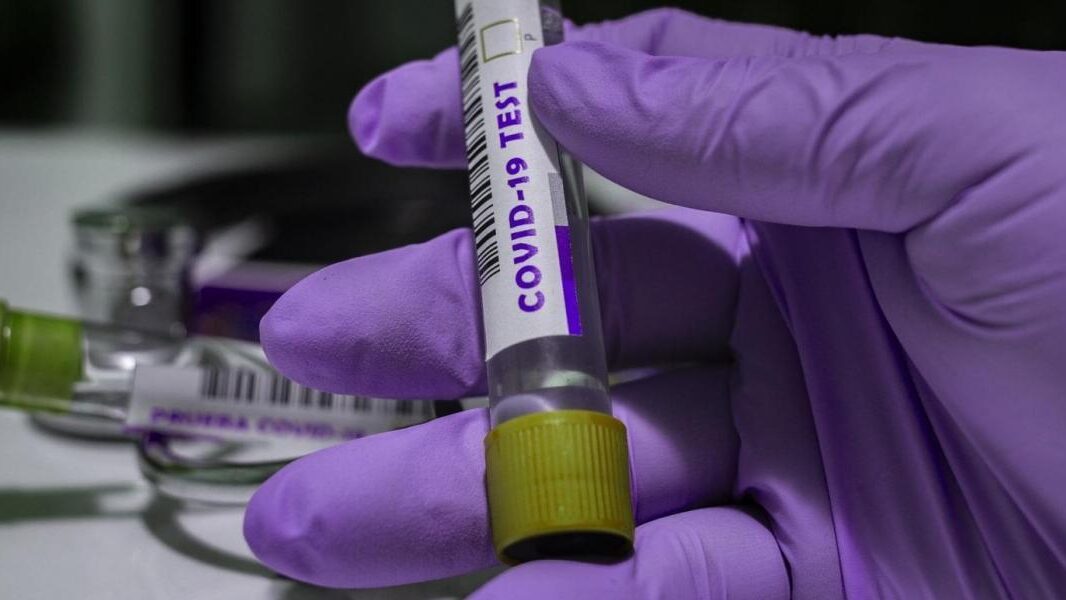 За сутки в Запорожской области зафиксировано более 700 случаев COVID-19