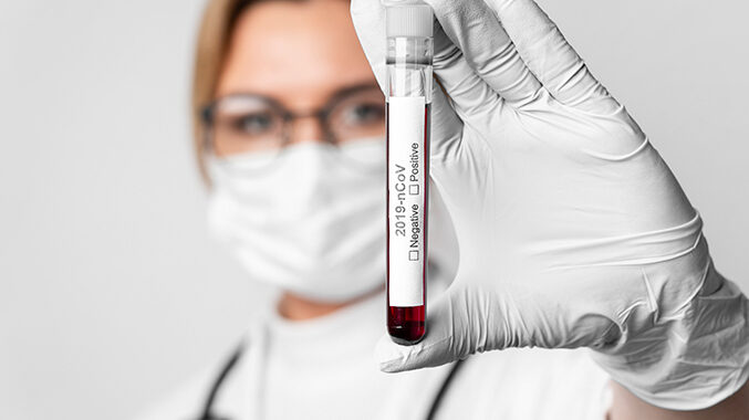 В Запорожской области число выздоровевших от COVID-19 превышает количество заболевших