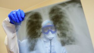 В Запорожской области от осложнений коронавируса скончались 6 пациентов