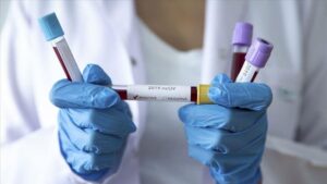 В Запорожье за последние сутки меньше 100 заболевших COVID-19