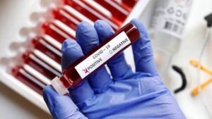 Почти три десятка жителей Запорожской области умерли от последствий коронавируса