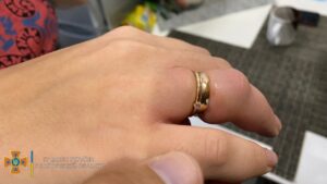 У Запорізькій області через набряк жінка не змогла зняти обручку: знадобилася допомога рятувальників, – ФОТО