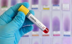 Жінка у реанімації: у Запоріжжі зафіксували випадок небезпечної інфекційної хвороби